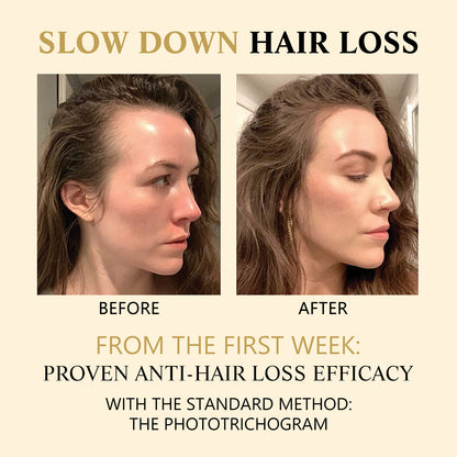 Hair Boost Darken Strengthen Essence Scalp Massage Moisturizing Hair 