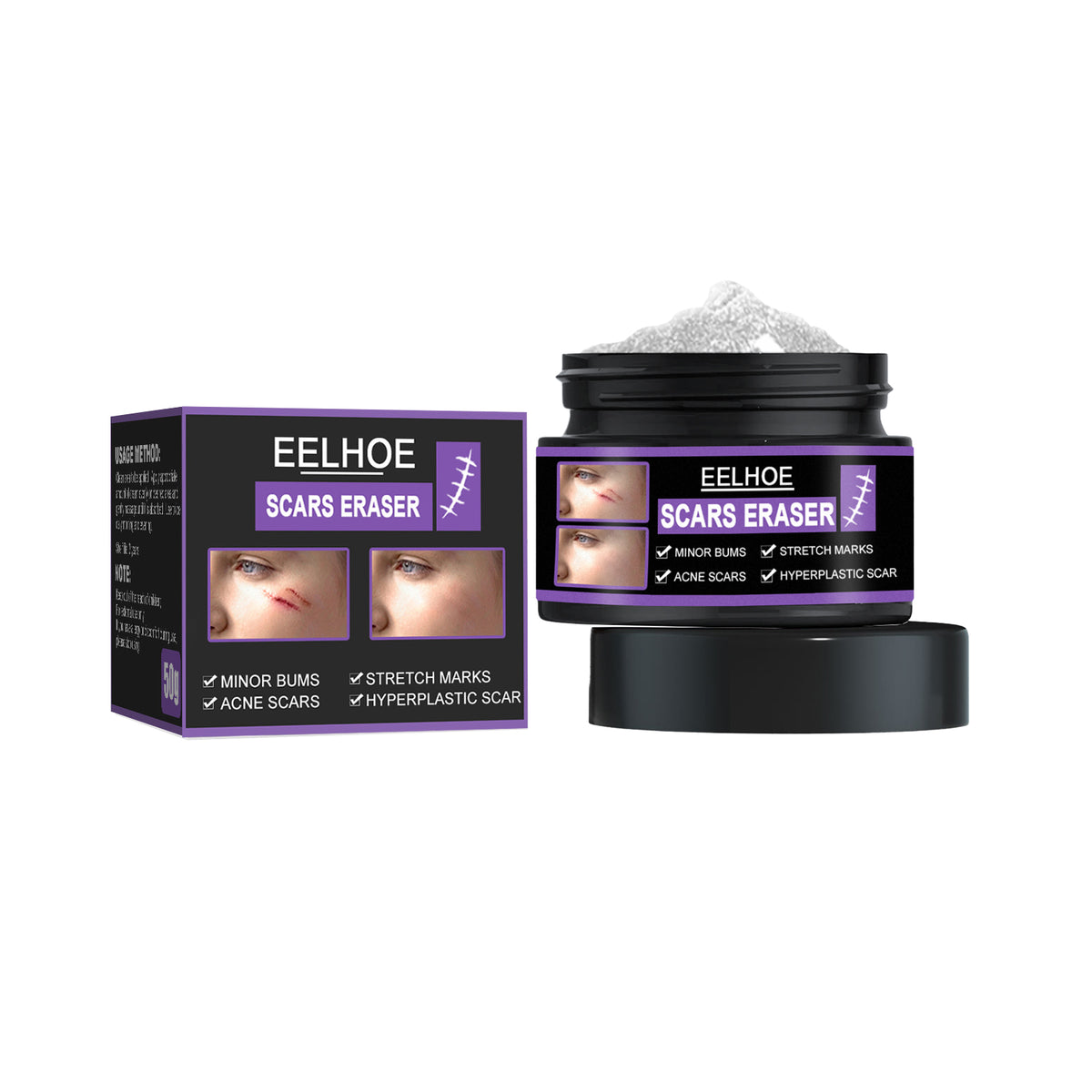 scar treatment cream